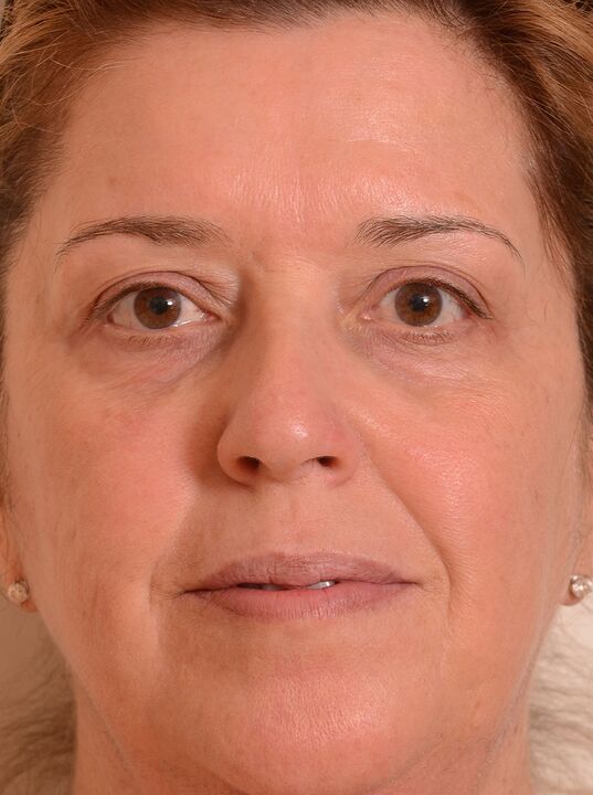 Omladil jsem svou tvář s krémem Eudalie