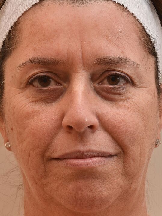 Takže jsem se podíval před použitím Eudalie Cream