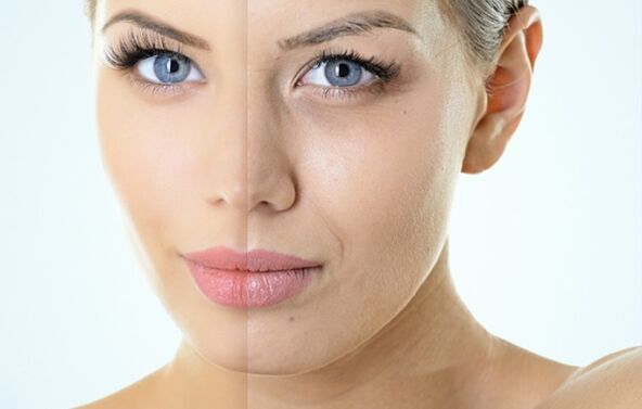 Indikace pro omlazení zlomku